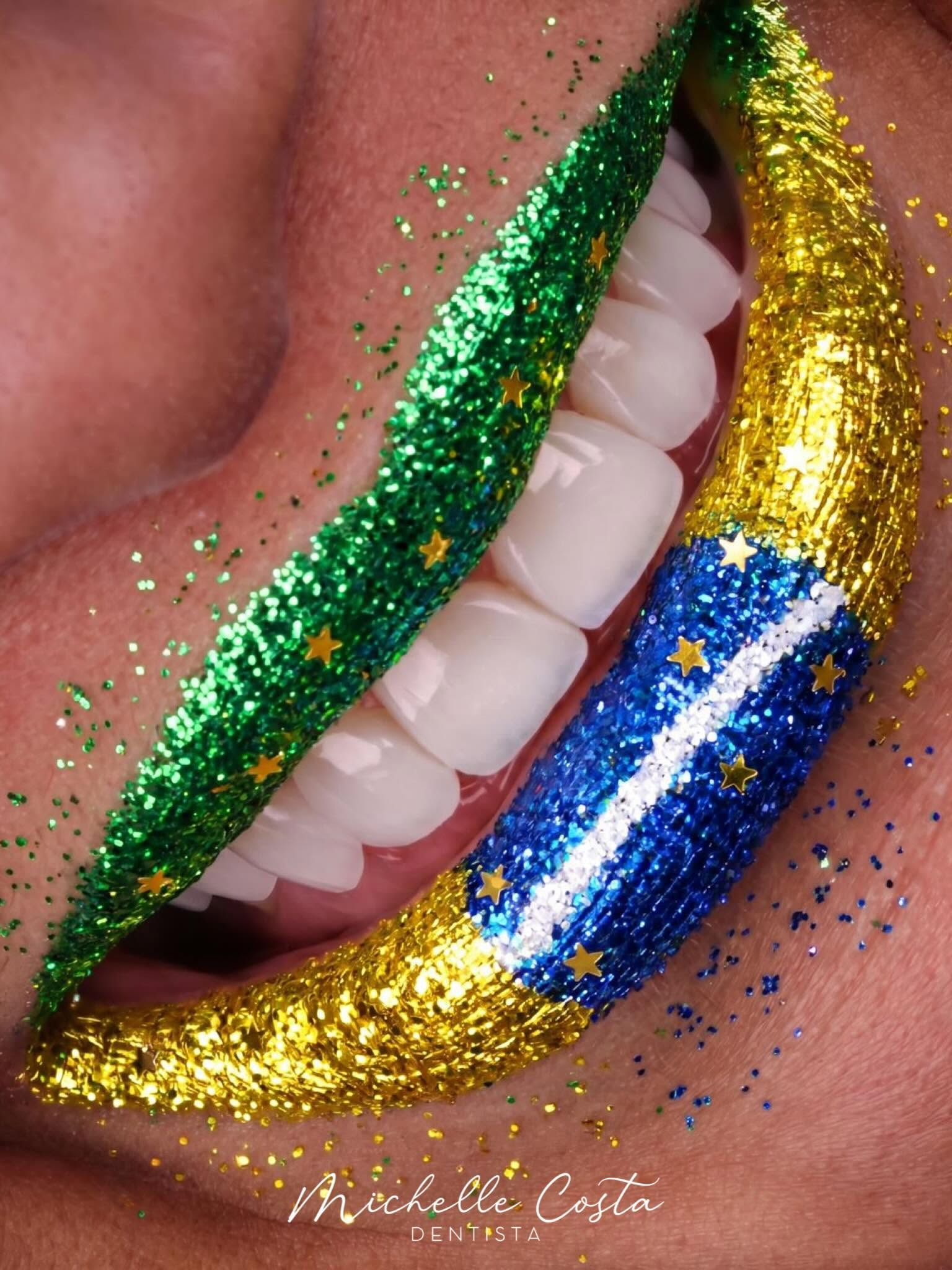 Lentes dentais em Madureira para estética do sorriso
